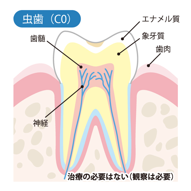 豊田市（若林）の歯医者、太田歯科医院の一般歯科